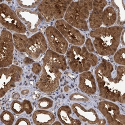 FBXO6 Antibody, Novus Biologicals:Antibodies:Primary Antibodies