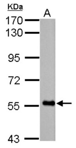 FBXO7 Antibody, Novus Biologicals 0.1mL; Unlabeled:Antibodies, Polyclonal