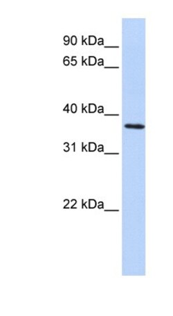 FBXO8 Antibody, Novus Biologicals:Antibodies:Primary Antibodies