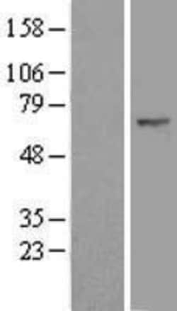 Novus Biologicals&trade;&nbsp;FBXW11 Overexpression Lysate