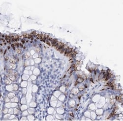FBXW12 Antibody, Novus Biologicals:Antibodies:Primary Antibodies