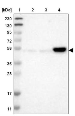 FBXW12 Antibody, Novus Biologicals:Antibodies:Primary Antibodies