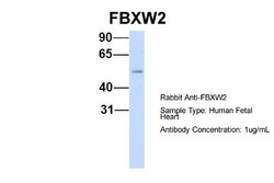 FBXW2 Antibody, Novus Biologicals 100&mu;L; Unlabeled:Antibodies, Polyclonal