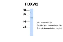 FBXW2 Antibody, Novus Biologicals 100&mu;L; Unlabeled:Antibodies, Polyclonal