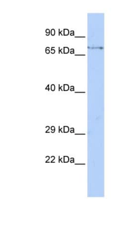 FBXW8 Antibody, Novus Biologicals 0.05mg; Unlabeled:Antibodies, Polyclonal
