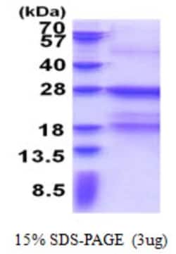 Novus Biologicals&trade;&nbsp;Recombinant Human Fc epsilon RI His Protein