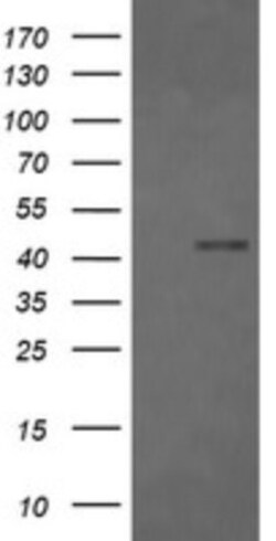 Fc gamma RI/CD64 Antibody (OTI1A8), Novus Biologicals 0.1mL; Unlabeled:Antibodies