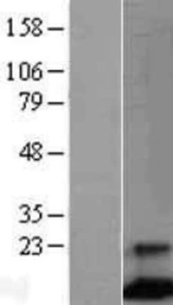 Novus Biologicals FCER1G Overexpression Lysate 0.1mg | Buy Online | Novus Biologicals&trade; | Fisher Scientific