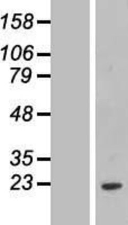Novus Biologicals&trade;&nbsp;FCF1 Overexpression Lysate