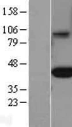 Novus Biologicals&trade;&nbsp;FCRN/FCGRT Overexpression Lysate