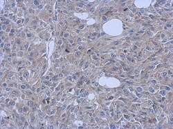 FCHO1 Antibody, Novus Biologicals 0.1mL; Unlabeled:Antibodies, Polyclonal
