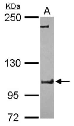 FCHO1 Antibody, Novus Biologicals 0.1mL; Unlabeled:Antibodies, Polyclonal