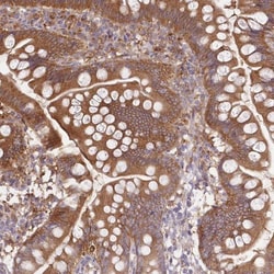 FCHO2 Antibody, Novus Biologicals 0.1mL; Unlabeled:Antibodies, Polyclonal