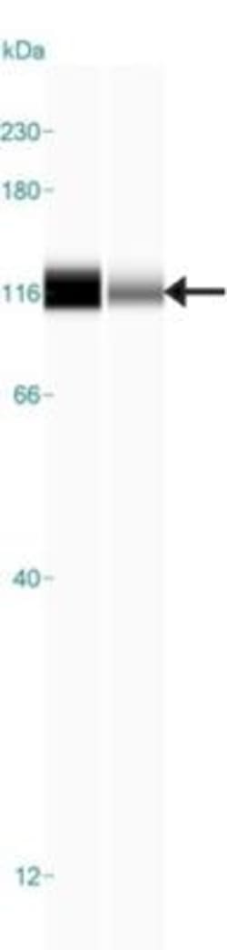 FCHO2 Antibody, Novus Biologicals 25 &mu;L | Buy Online | Novus Biologicals | Fisher Scientific