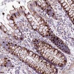 FCHSD2 Antibody, Novus Biologicals:Antibodies:Primary Antibodies