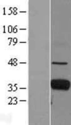 Novus Biologicals&trade;&nbsp;Ficolin-1 Overexpression Lysate