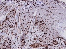FCP1 Antibody, Novus Biologicals 0.1mg; Unlabeled:Antibodies, Polyclonal