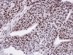 FCP1 Antibody, Novus Biologicals 0.1mg; Unlabeled:Antibodies, Polyclonal