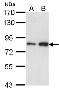 FCP1 Antibody, Novus Biologicals 0.1mg; Unlabeled:Antibodies, Polyclonal