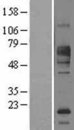 Novus Biologicals&trade;&nbsp;FCRL1/FcRH1 Overexpression Lysate