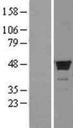 Novus Biologicals&trade;&nbsp;FDFT1 Overexpression Lysate
