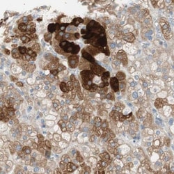 FDFT1 Antibody, Novus Biologicals 0.1mL; Unlabeled:Antibodies, Polyclonal