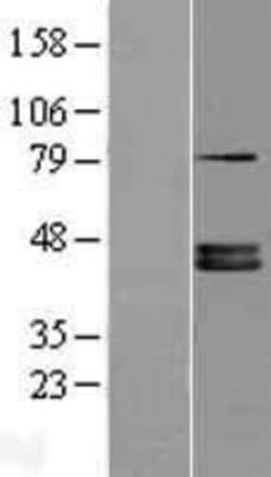 Novus Biologicals™ FDPS Overexpression Lysate