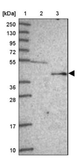 FECH Antibody, Novus Biologicals 25 &mu;L, Unlabeled:Antibodies, Polyclonal