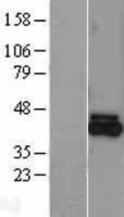 Novus Biologicals&trade;&nbsp;FECH Overexpression Lysate