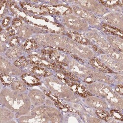 FECH Antibody, Novus Biologicals 25 &mu;L | Buy Online | Novus Biologicals | Fisher Scientific