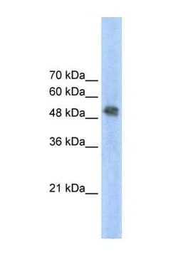 FECH Antibody, Novus Biologicals 0.1mg; Unlabeled:Antibodies, Polyclonal