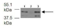 FECH Antibody, Novus Biologicals 0.1mg; Unlabeled:Antibodies, Polyclonal