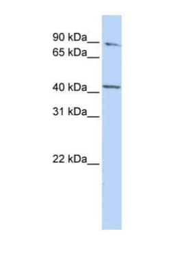 FECH Antibody, Novus Biologicals 100&mu;L; Unlabeled:Antibodies, Polyclonal