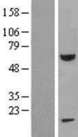 Novus Biologicals&trade;&nbsp;FEM1B Overexpression Lysate