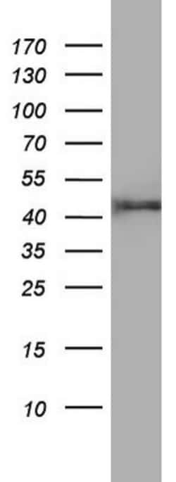 FEN-1 Antibody (OTI1F3), Novus Biologicals 0.1mL; Unlabeled:Antibodies,