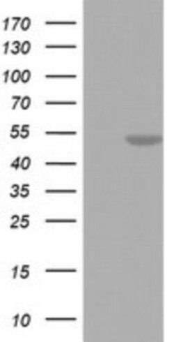 FEN-1 Antibody (OTI1F3), Novus Biologicals 0.1mL; Unlabeled:Antibodies,