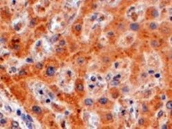 FENS1 Antibody, Novus Biologicals 0.1mg; Unlabeled:Antibodies, Polyclonal