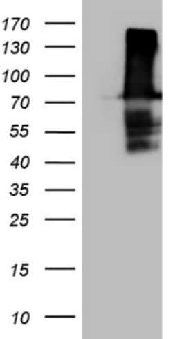 FERMT3/URP2 Antibody (OTI3C7), Novus Biologicals 0.1mL; Unlabeled:Antibodies,
