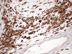 FERMT3/URP2 Antibody (OTI3C7), Novus Biologicals 0.1mL; Unlabeled:Antibodies,