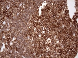 FERMT3/URP2 Antibody (OTI3C7), Novus Biologicals 0.1mL; Unlabeled:Antibodies,