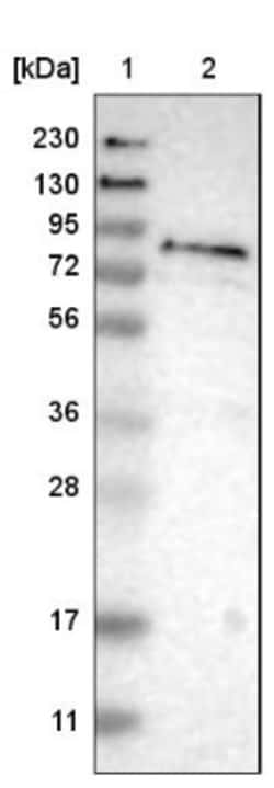 ferric-chelate reductase 1 Antibody, Novus Biologicals 25 &mu;L; Unlabeled:Antibodies,