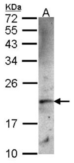 Ferritin Heavy Chain Antibody, Novus Biologicals 0.1mL; Unlabeled:Antibodies,