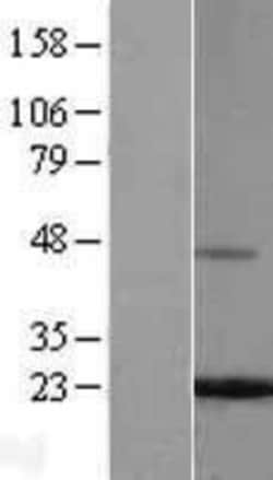 Novus Biologicals&trade;&nbsp;Ferritin Light Chain Overexpression Lysate