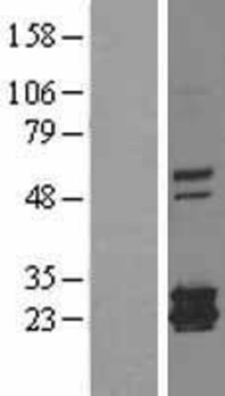 Novus Biologicals™ Ferritin mitochondrial Overexpression Lysate