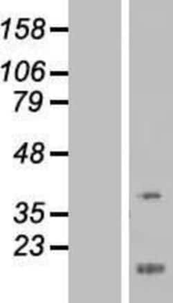 Novus Biologicals&trade;&nbsp;FEZ1 Overexpression Lysate