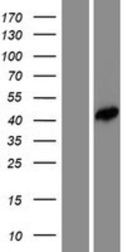Novus Biologicals&trade;&nbsp;FEZ2 Overexpression Lysate
