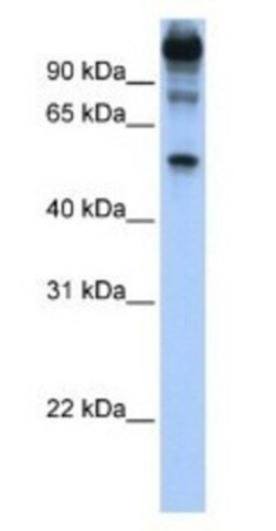 FEZF1 Antibody, Novus Biologicals:Antibodies:Primary Antibodies