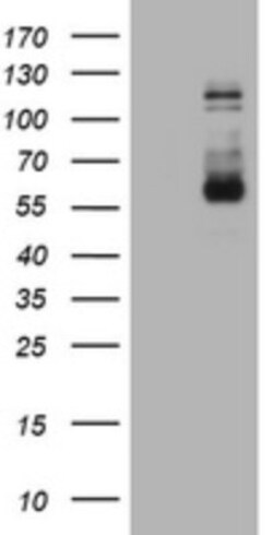 FGFR3 Antibody (OTI1B10), Novus Biologicals 0.1mL; Unlabeled:Antibodies,