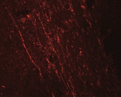 FGFR3 Antibody - BSA Free, Novus Biologicals:Antibodies:Primary Antibodies