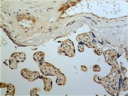 FGF-11 Antibody (MM0282-6J20) - Azide and BSA Free, Novus Biologicals 0.025